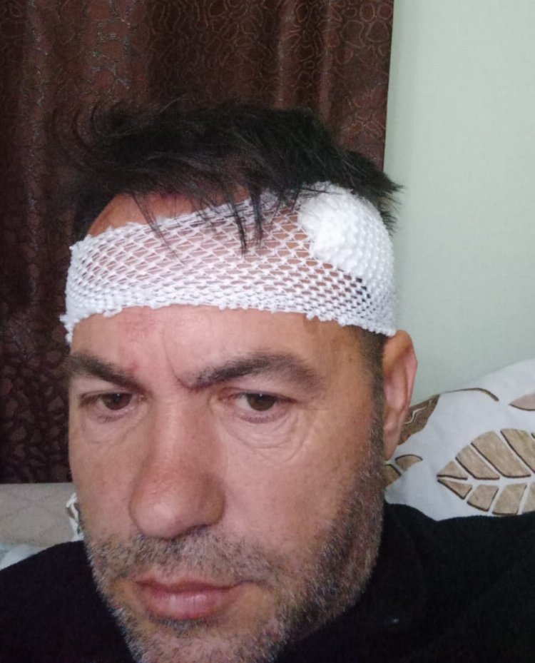 Didim Belediyesi’nin eski personelinden saldırı iddiası!