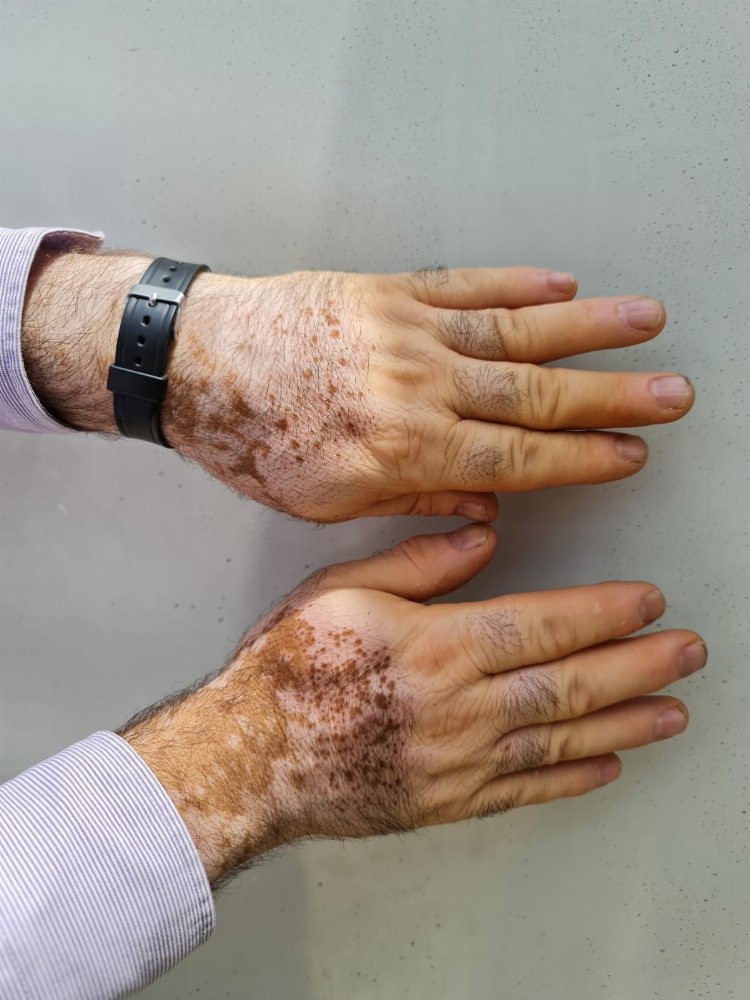 Dokuz Eylül afet bölgesinde salgına karşı teyakkuzda