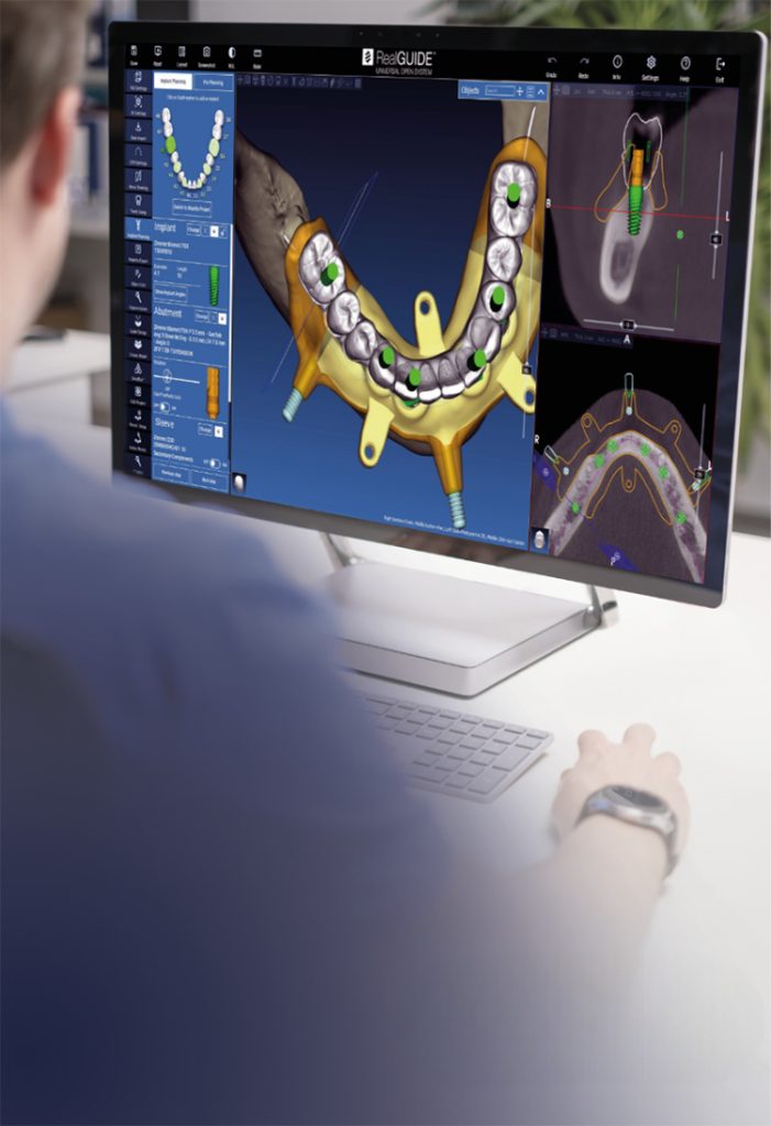 ‘Yapay zeka’ diş hekimliğine başlıyor!